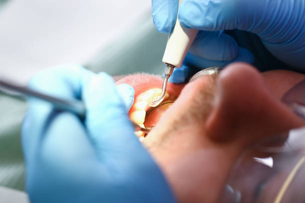 Best Emergency Treatment for Toothache in St Ann, MO