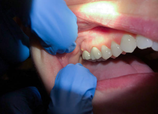 Best Weekend Emergency Dentist in St Ann, MO