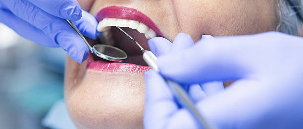 Best Emergency Root Canal Treatment in St Ann, MO