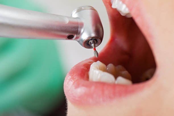Best Weekend Emergency Dentist in St Ann, MO